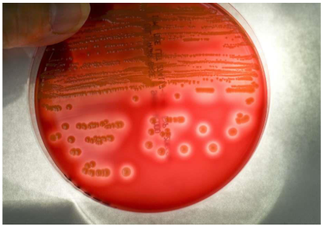 <p>The discoloration revealed in this culture medium is what caused by the exposure of what component of this medium?</p>