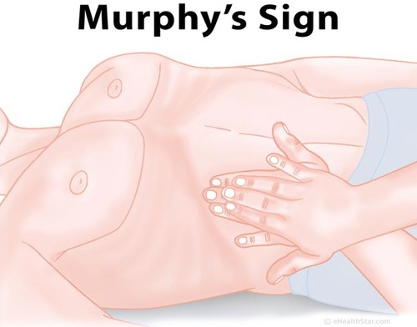 <p>deep palpation of RUQ under the rib during inspiration</p>