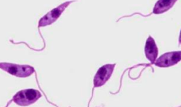 <p>What morphologic state of a leishmania is this?</p>