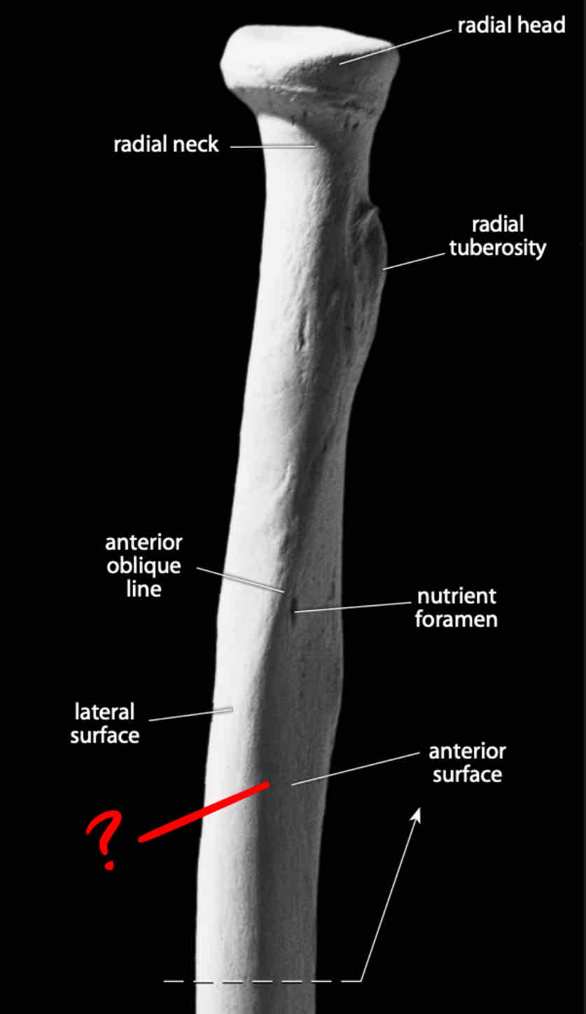 term image
