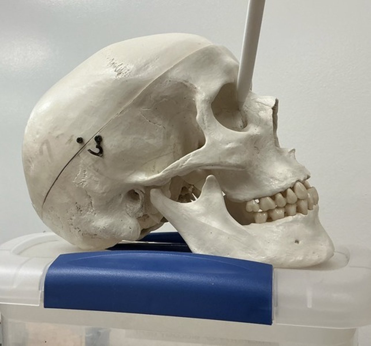 <p>What bone is this?</p>