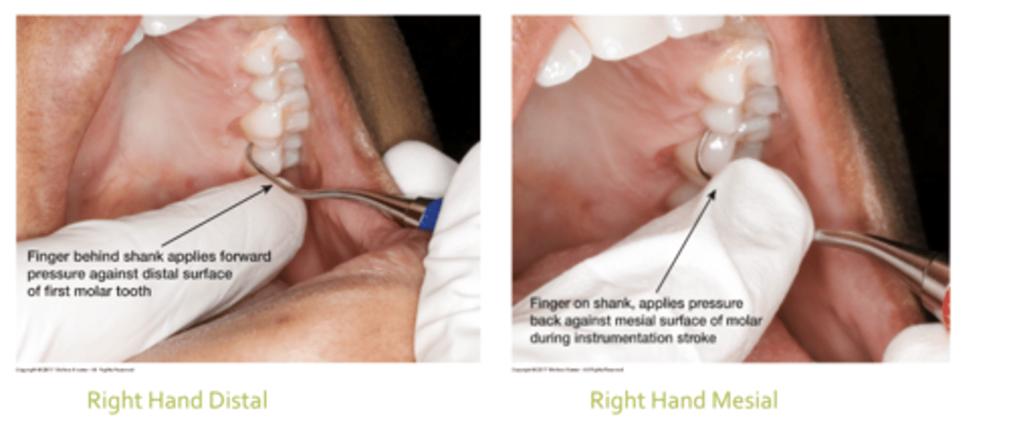 <p>distal behind</p><p>mesial on top</p>