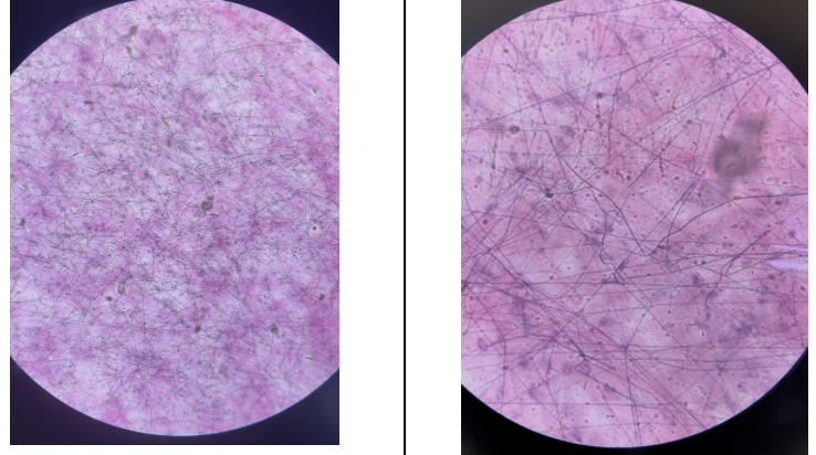 <p>Name this connective tissue type</p>