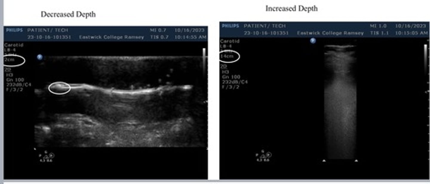<p>Describes the maximum distance into the body that an ultrasound system is imaging. It also adjust how far or how close we see the body.</p><p>Increase depth- image is farther showing a more zoomed out view</p><p>Decreased depth- images closer showing a more zoomed in view</p>