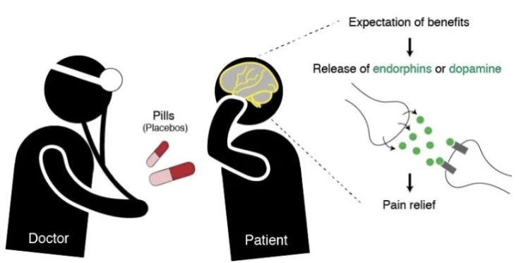 <p>•Decrease anxiety<span>•Decrease anxiety</span></p><p><span>–Reduce physical symptoms of stress</span></p><p><span>•Upset stomach</span></p><p><span>•Diarrhea</span></p><p><span>•Trouble sleeping</span></p><p><span>–Not all placebo effects have to do with these things</span></p><p></p><p><span>•Endorphin release</span></p><p><span>–Endogenous opioids naturally produced by the body</span></p><p><span style="font-family: &quot;Arial MT&quot;">•</span><span>When you give someone a placebo, their body releases endorphins, which relieve your pain.</span></p><p><span>–</span><span style="font-family: &quot;Arial MT&quot;">The</span><span> </span><span style="font-family: &quot;Arial MT&quot;">more</span><span> </span><span style="font-family: &quot;Arial MT&quot;">believable the</span><span> </span><span style="font-family: &quot;Arial MT&quot;">placebo, the more likely it is to work:</span></p><p><span>•</span><span style="font-family: &quot;Arial MT&quot;">In</span><span> </span><span style="font-family: &quot;Arial MT&quot;">brain imaging study, the more that patients expected the placebo to work, the more brain activity in their opioid receptors.</span></p><p><span>Endogenous (released in body naturally)</span></p><p></p><p><span>•Expectations</span></p><p><span>Changes brains activity releasing hormones Endorphins releases pain relief</span></p>