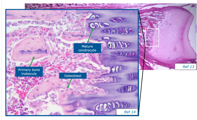 <p>A complex process consisting of cell migration, differentiation, extracellular deposition and mineralisation</p><p>The two stages are Intramembranous ossification (direct bone formation) and endochondral ossification (cartilage is a precursor to bone)</p>