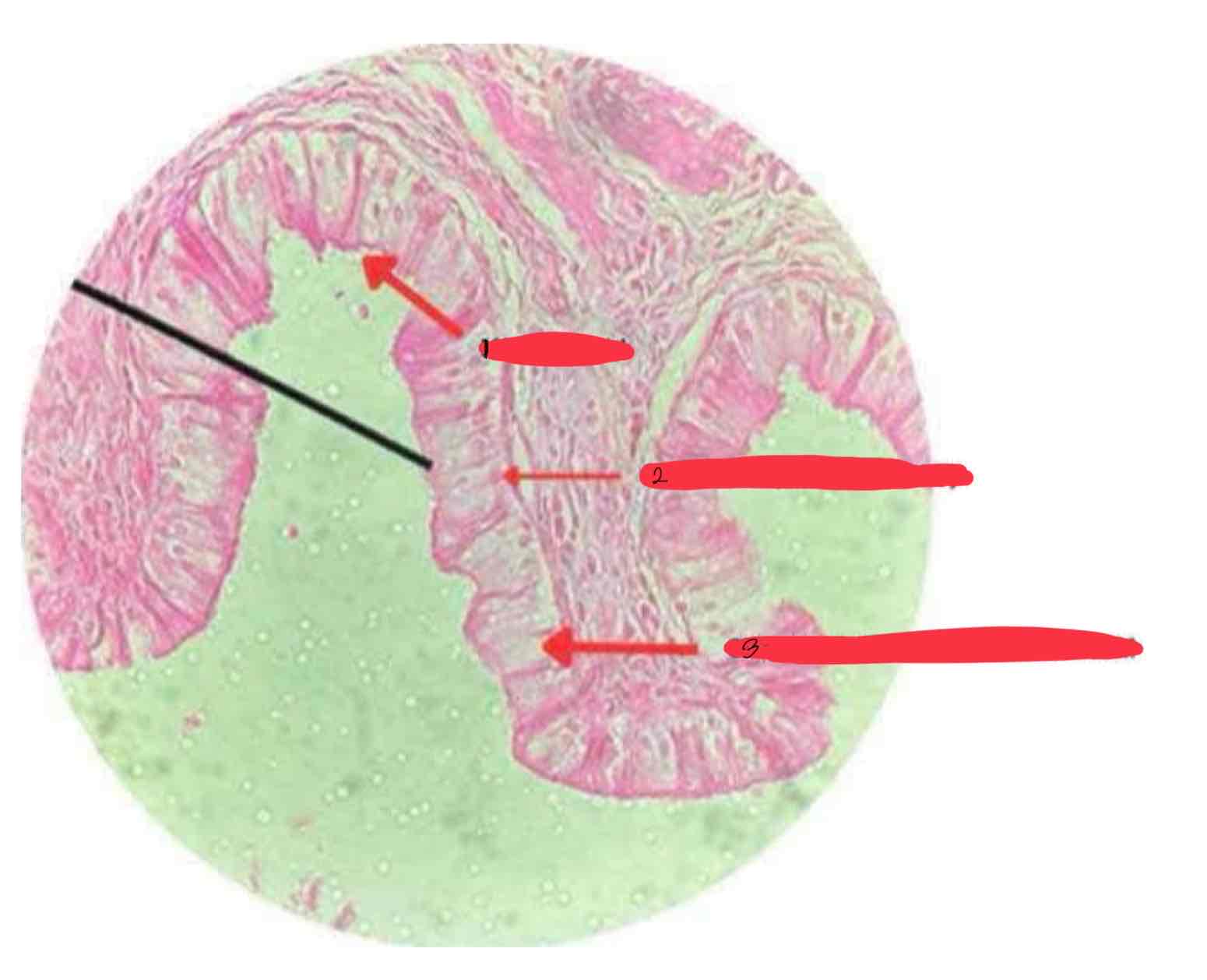 <p>Gall bladder</p>