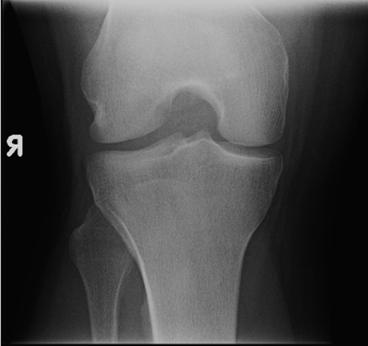 <p>ID standard knee projection</p>