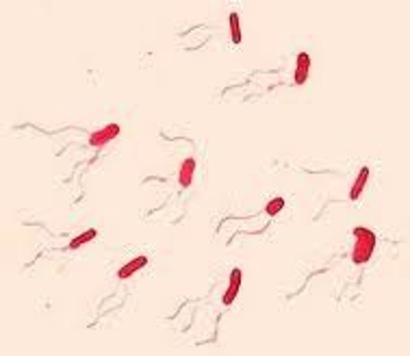 <p>Gram-negative coccobacillus</p><p>Causes tracheobronchitis and pneumonia</p>