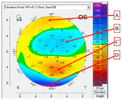 <p><span>Look at the attached topography. &nbsp;What does point C describe?</span></p>