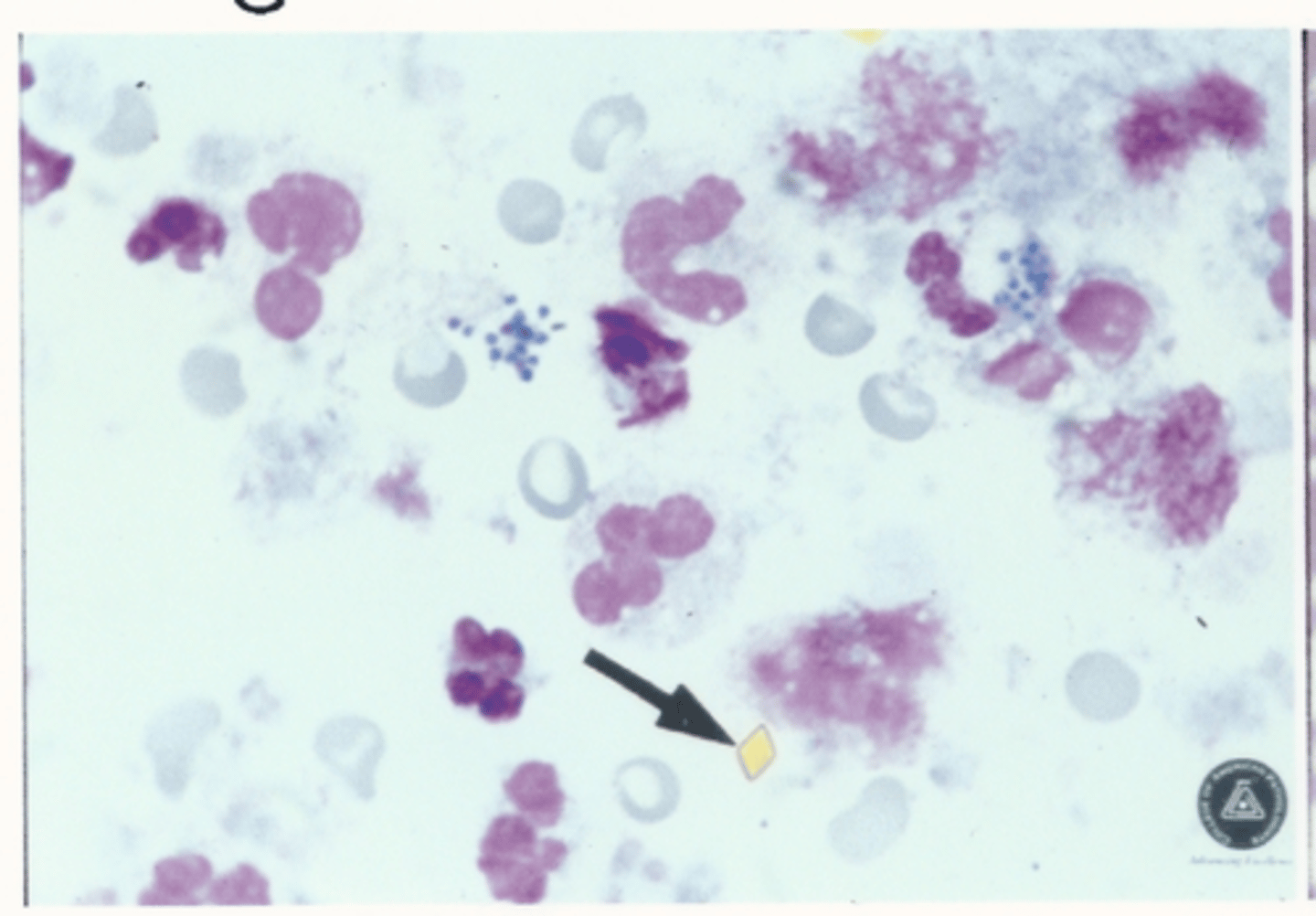 <p>Identify the cells in this body fluid</p>