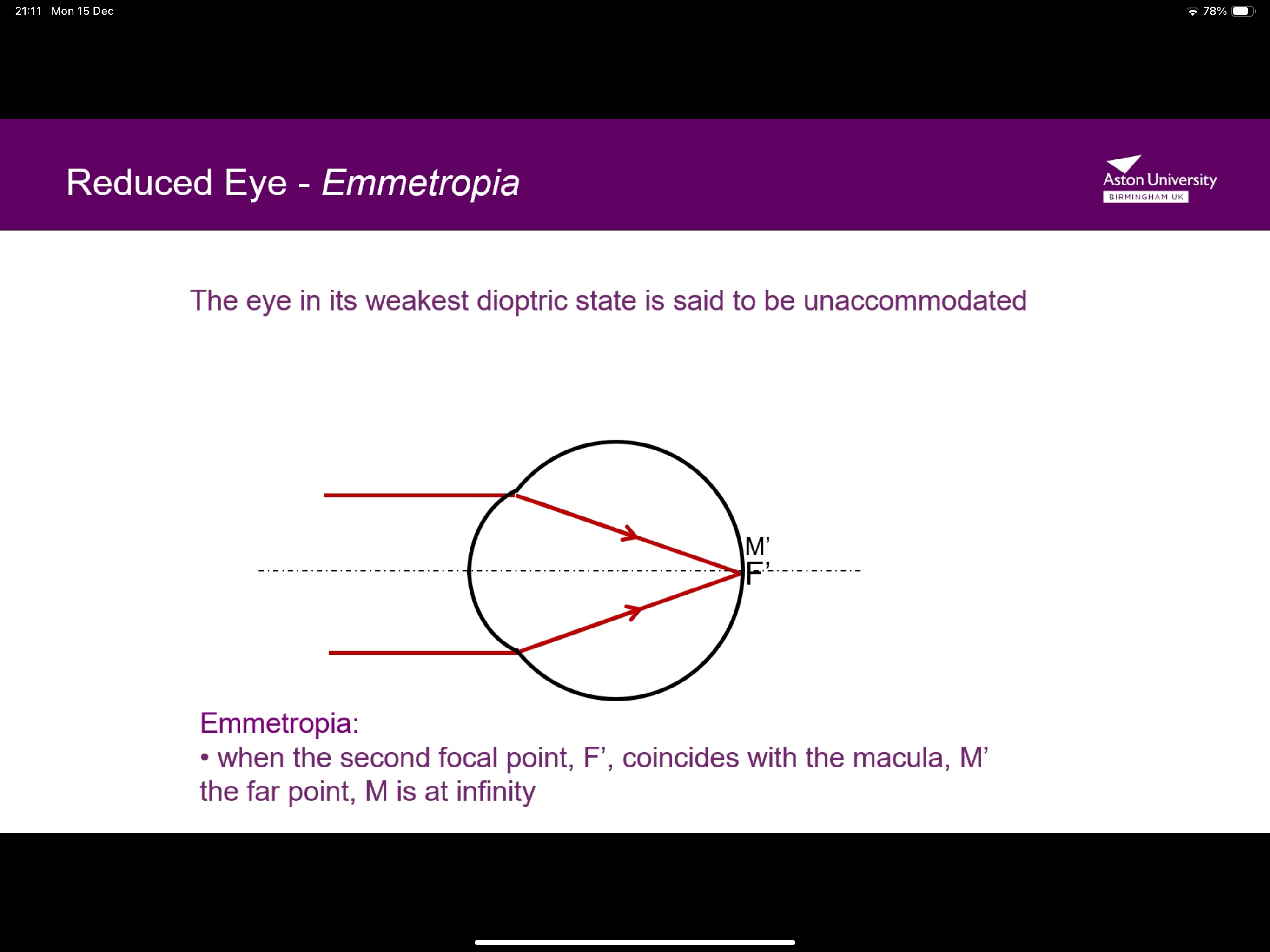 <p>When the second focal point coincides with the macula</p>