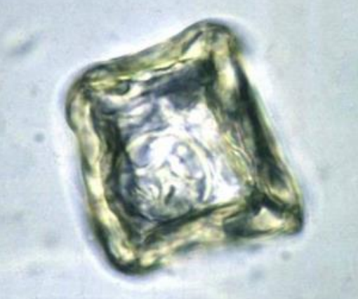 <p>name the parasite and describe egg:</p>