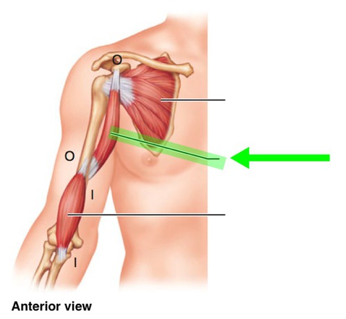 <p>flexes and adducts arm</p>