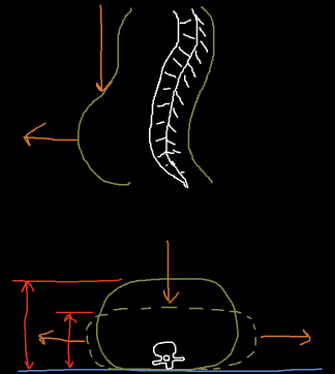 <p>Patient thickness effect on factor selection</p>