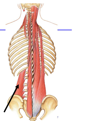 <p>Origin: Iliolumbar ligament and iliac crest</p><p>Insertion: Lower border of 12th rib, transverse process of lumbar vertebrae</p><p>Action: Depresses rib cage inferiorly and laterally flexes trunk</p>