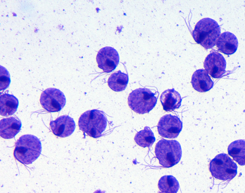 <p><strong>General characteristics:</strong></p><ul><li><p>Flagellated protozoan parasite.</p></li><li><p>Causes trichomoniasis, a sexually transmitted infection.</p></li><li><p>Found in the urogenital tract.</p></li></ul><p></p>