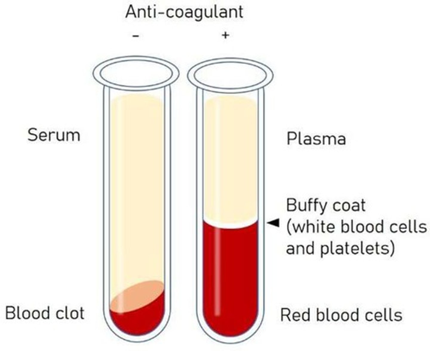 <p>Clotted blood collected using a Serum Separator Tube, commonly used for serological testing.</p>