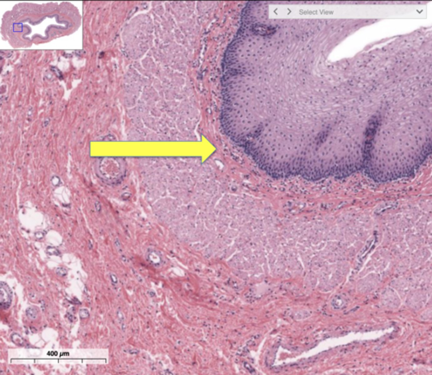 <p>underlying layer of areolar tissue that supports the respiratory epithelium</p>