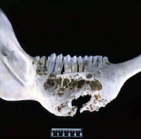 <p>Por Actinomyces (Gram+) después de una herida en cavidad oral o piel.</p><p>Bacterias comensales en cavidad oral, intestino y vías respiratorias altas. </p><p>Afecta bovinos, perros, caballos, camellos, cerdos, cabras y gatos, también le llaman “mandíbula de gaucho”. produce osteomielitis y nódulos en la piel.</p><ul><li><p>Caballos: linfadenitis mandibular, abscesos y fístulas</p></li><li><p>Perros y gatos: nódulos más leves en cabeza, cuello y tórax</p></li><li><p>Cerdos: ubre y región ventral </p></li><li><p>Cabras: piernas y hombros</p></li></ul><p></p>