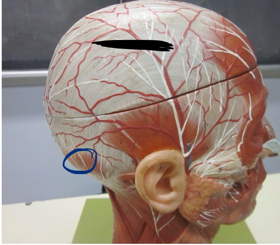 <p>Which muscle</p>
