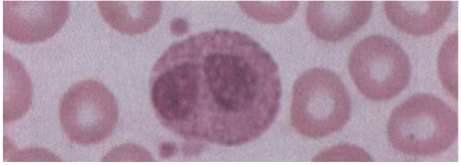 <p>Eosinophils </p>