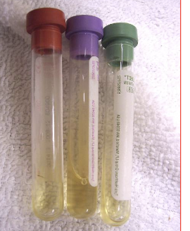 <p>-clear to straw colored</p><p>-watery (equine fluid should not clot)</p><p>-cytology: neuts and mononuclear cells predominate in horses</p>