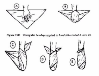 <p>What kind of bandage is this</p>