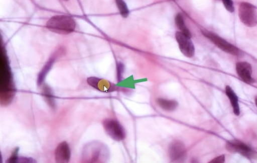 <p>Fibroblast </p>