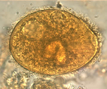 <p>Balantidium coli </p><p>Troph= 50-100 um</p><p>Cyst= 50-70 um</p>
