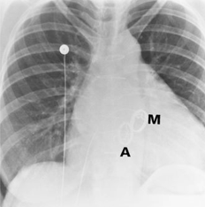 term image