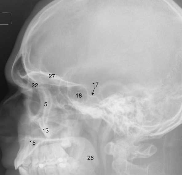 <p>What is 18 </p>