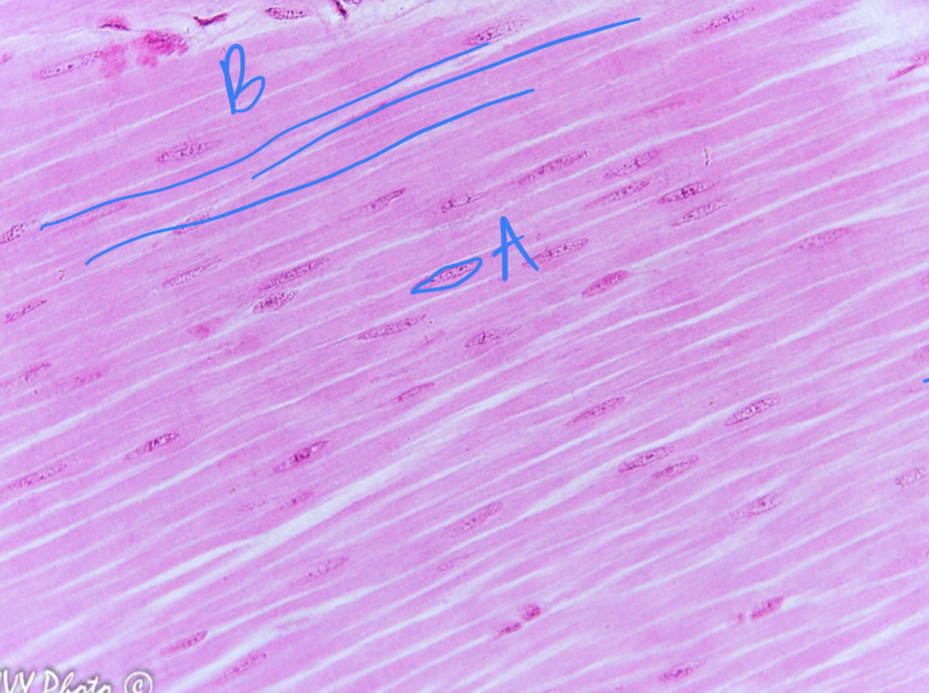 <ul><li><p>tissue type</p></li><li><p>label</p></li><li><p>does it have striations?</p></li><li><p>voluntary or involuntary?</p></li></ul>