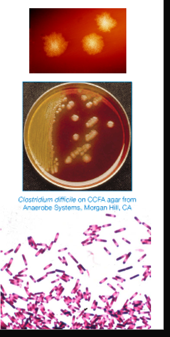 <ul><li><p>large, straight, thin GPB</p></li><li><p>produces oval, subterminal spores rarely seen</p></li><li><p>motile</p></li><li><p>circular or rhizoid colonies</p><ul><li><p>2-5mm</p></li></ul></li><li><p>characteristic odor: manure, stable</p></li><li><p>in BAP fluoresce chartreuse under UV light</p></li><li><p>grows in cycloserine, cefoxitin-fructose agar (CCFA)</p><ul><li><p>yellow colonies w ground appearance </p></li></ul></li></ul><p></p>
