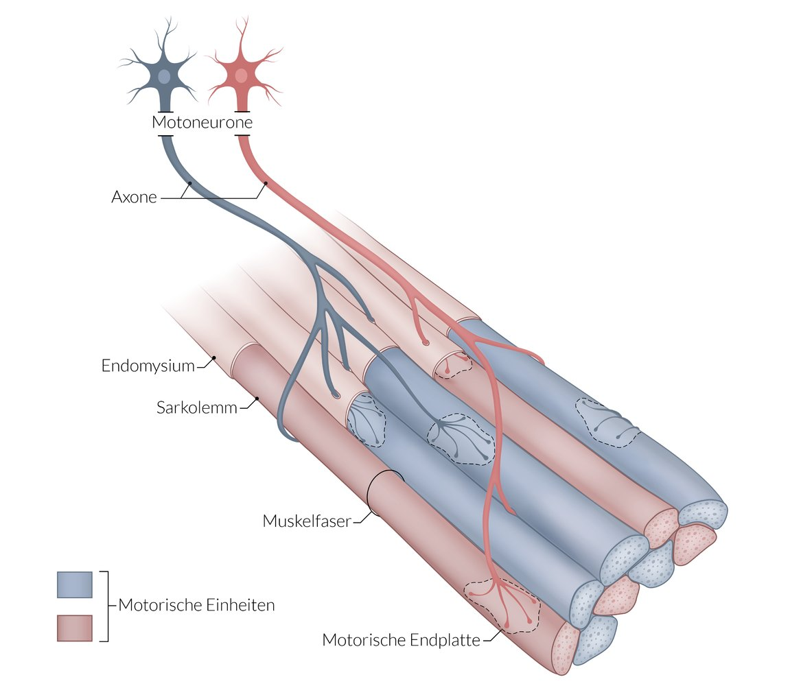 <p>E. Recruitment of additional motor units</p>