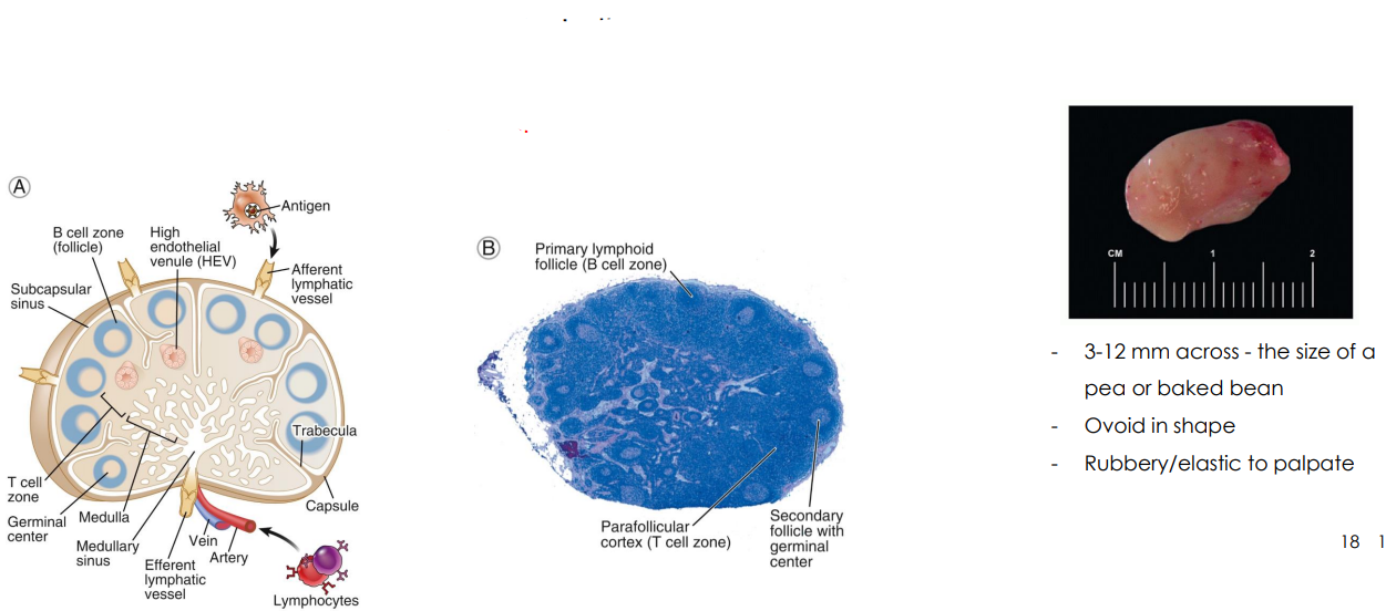 <p>Lymph Node Size etc.</p>