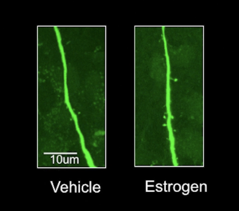 <p>Treating ventromedial nucleus of the hypothalamus induces synaptic terminals and increases dendritic spine density in vlVMH (ventrolateral VMH) but not in dorsal portion of VMH.</p><p>Note that these neurons that grew dendritic spines did NOT contain estrogen receptors!!! VERY IMPORTANT. Most likely estrogen sensing neurons <strong><u>transsynaptically</u></strong> induced other neurons to grow spines.</p>