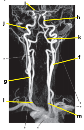 <p>What is letter g ?</p>