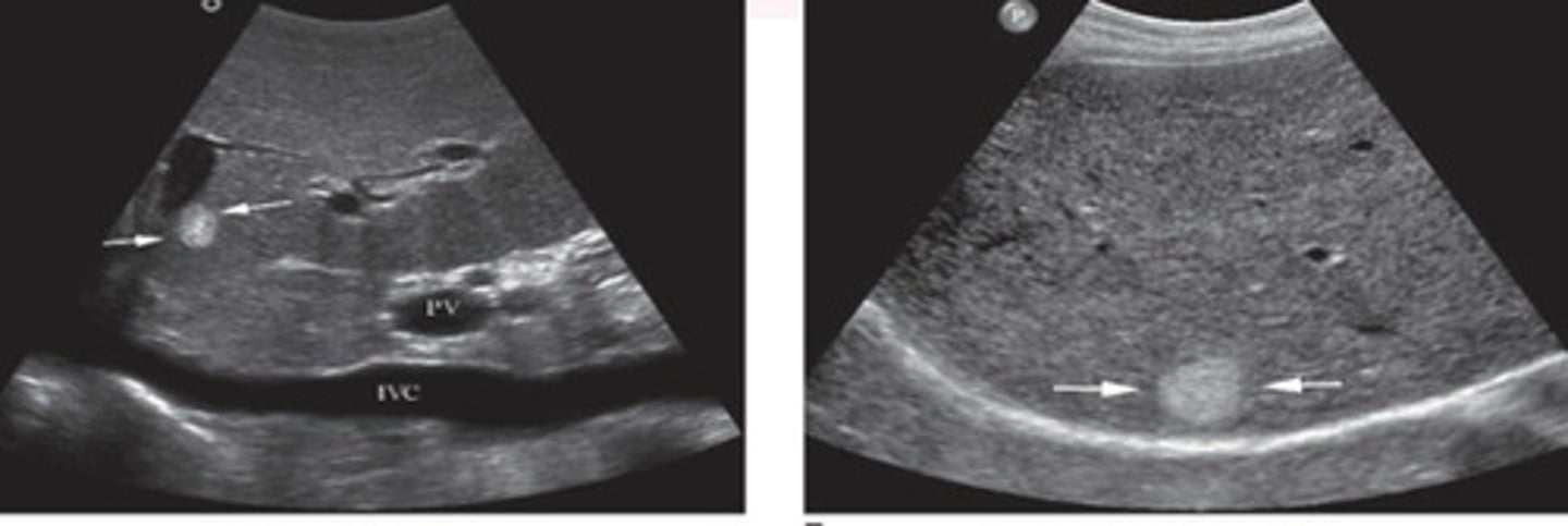 <p>What does this image show</p>