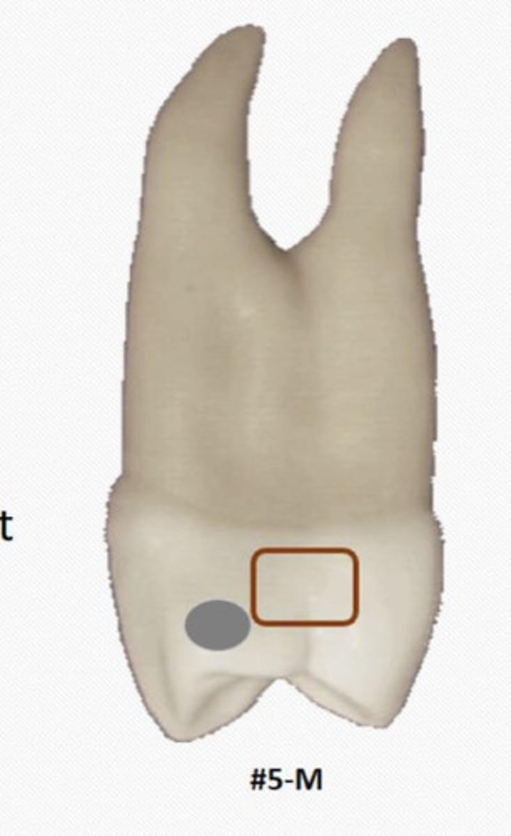 <p>Maxillary first premolar crowns have a prominent</p><p>__ cervical to the contact area</p>