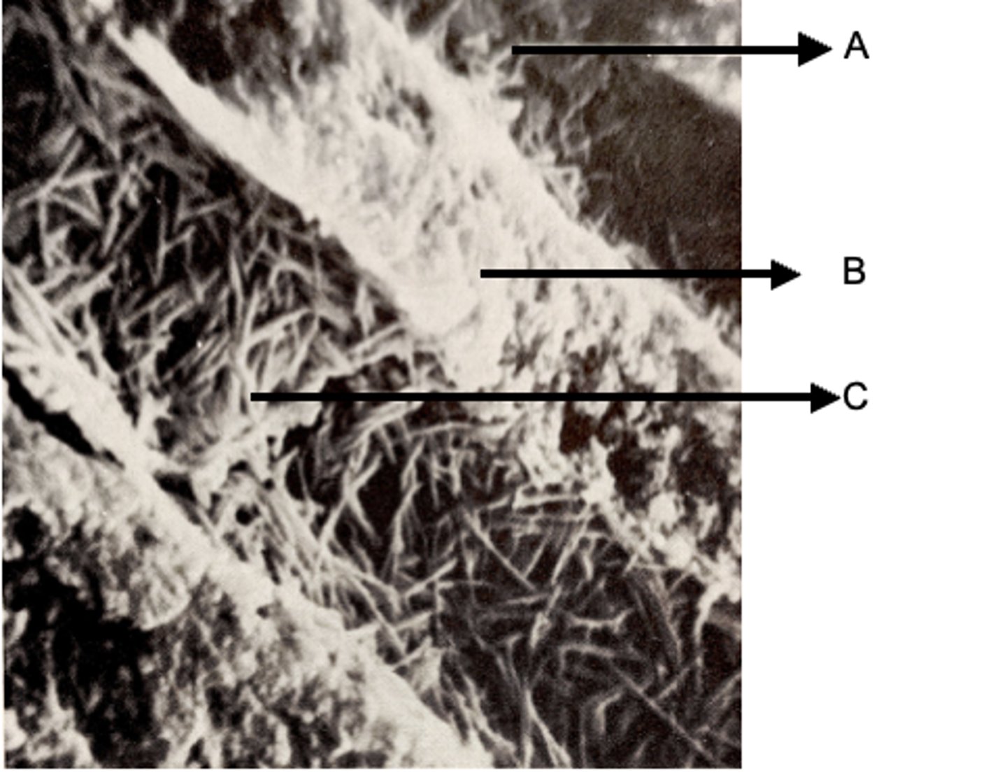 <p>A: Dentinal tubule</p><p>B: Intertubular dentin</p><p>C: Dentinal tubule</p>