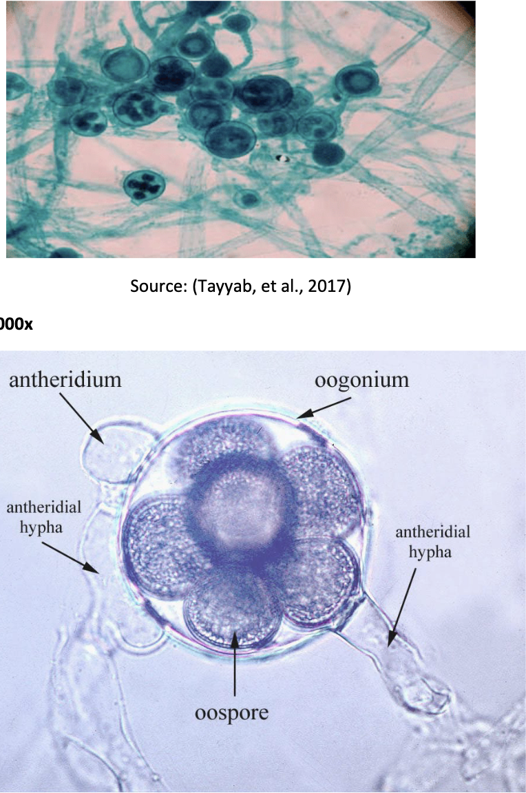 ex) water mild, saprolegnia

Repro structure: oogonium

Spore: oospore

Protists