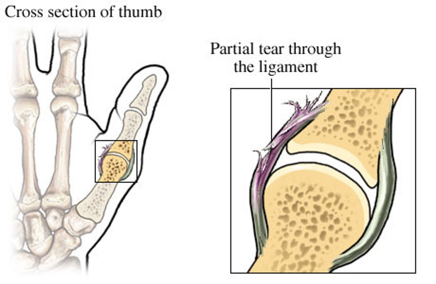 <p>- Connect bone to bone</p><p>- Thick bands of fibrous tissue that help thicken and reinforce the joint capsule</p><p>- Prevent bone from dislocating during normal movement.</p><p>Characteristics</p><p>1. Connective tissue</p><p>2. Many collagen fibers</p><p>3. Elastic and Flexible</p><p>4. Can be short and thin OR longer and thicker.</p>