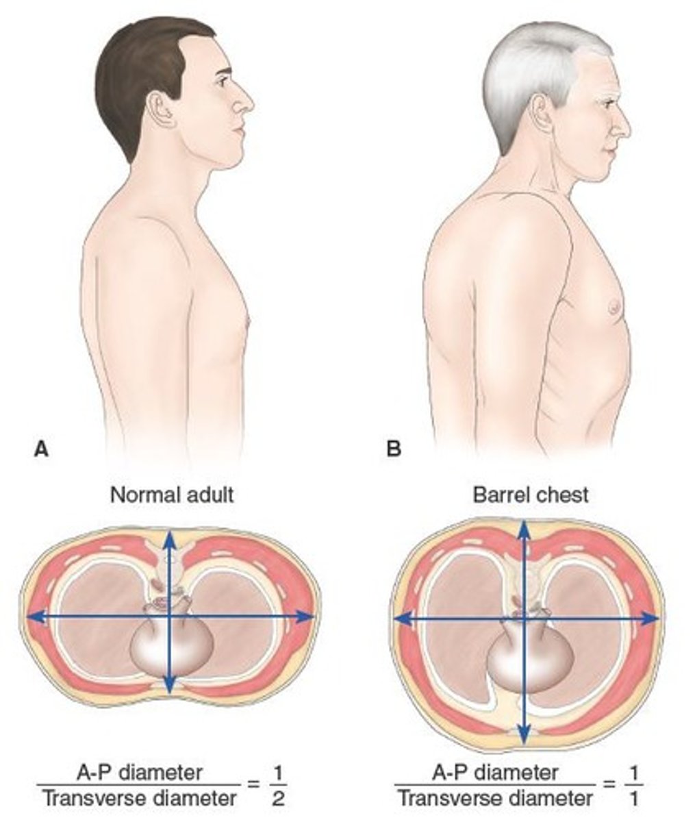 <p>✓ Chronic cough</p><p>✓ Sputum production</p><p>✓ Dyspnea</p><p>✓ Weight loss</p><p>✓ Use of accessory muscles</p><p>✓ Barrel chest</p><p>✓ Musculoskeletal wasting</p><p>✓ Depression</p>