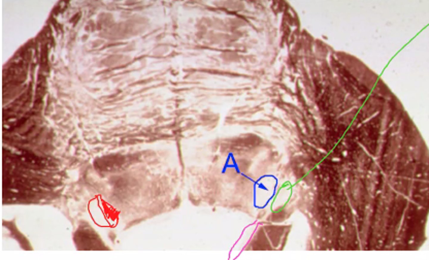 <p>Identify the structures indicated by the pink outline</p>