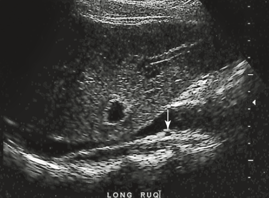 <p>which of the following vascular structures does the arrow identify</p>