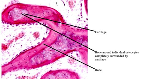 <p>-trans-differentiation of cartilage into bone tissue in human fetal mandible</p>