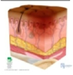 <p>skin is unbroken but red and inflamed </p>