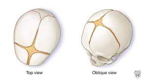 Gaps between a baby's skull that slowly close up during the first 2-24 months. Allow passage through birth canal and allow the brain to grow.