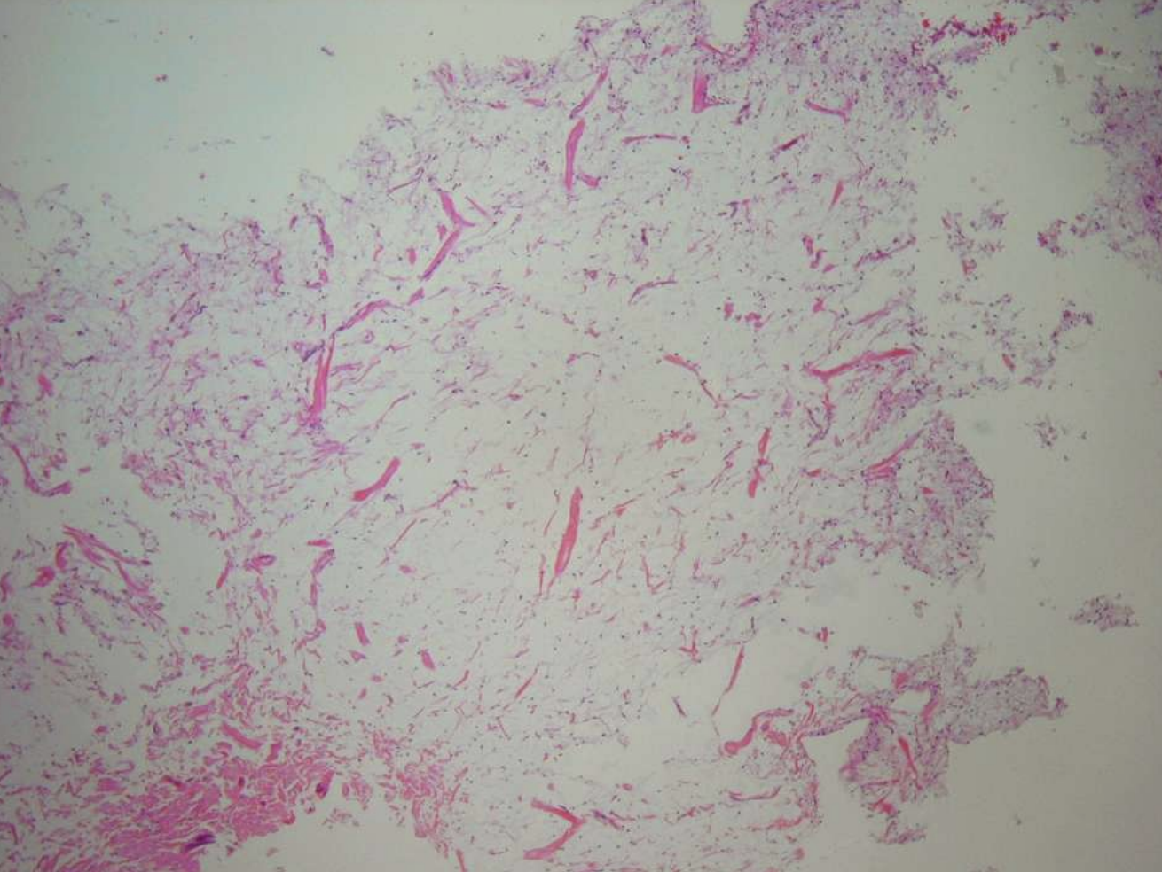 <p>what are histopathologic features of Odontogenic Myxoma?</p>